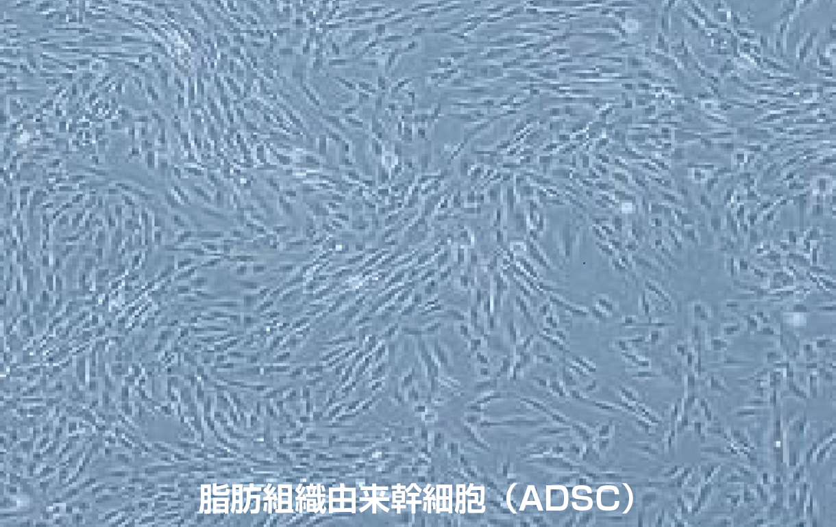 脂肪細胞由来幹細胞(ADSC)