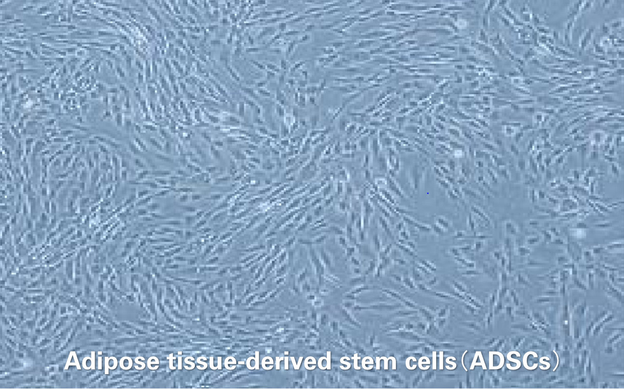 Adipose tissue-derived stem cells（ADSCs）