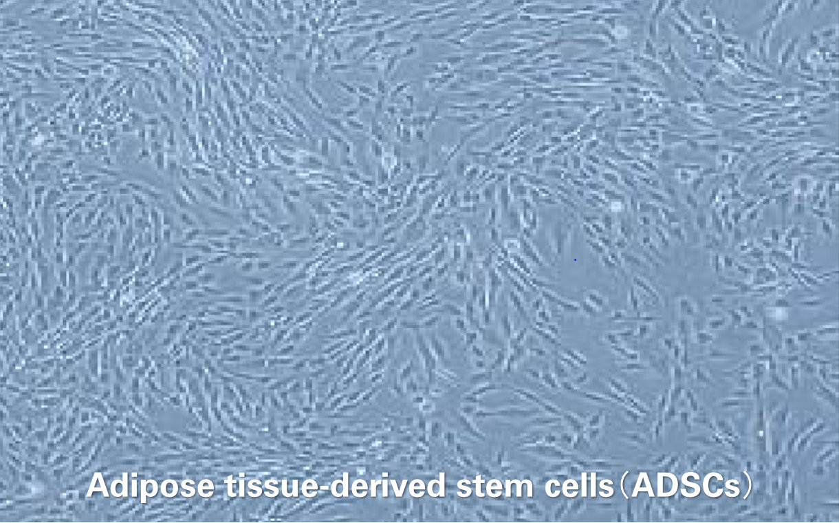 Adipose tissue-derived stem cells(ADSCs)